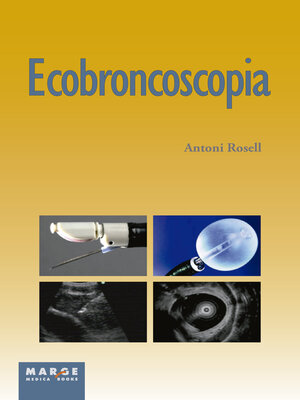 cover image of Ecobroncoscopia